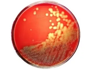 замовити, купити Агар кров´яний з кров´ю барана, 20 чаш/уп від Biolife Italiana S.r.l. за низькою ціною в Україні