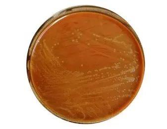 замовити, купити Агар шоколадний збагачений, 20 чаш/уп від Biolife Italiana S.r.l. за низькою ціною в Україні