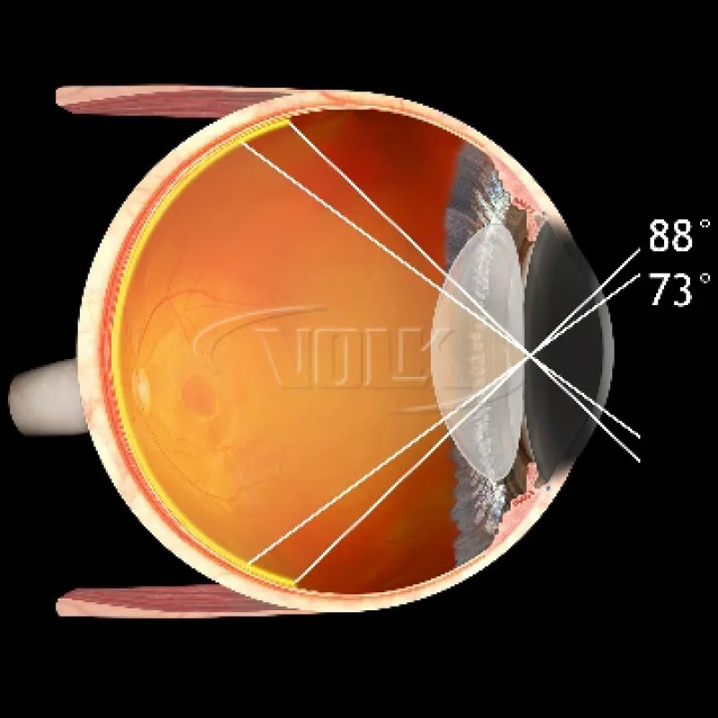Central Retina ACS®
