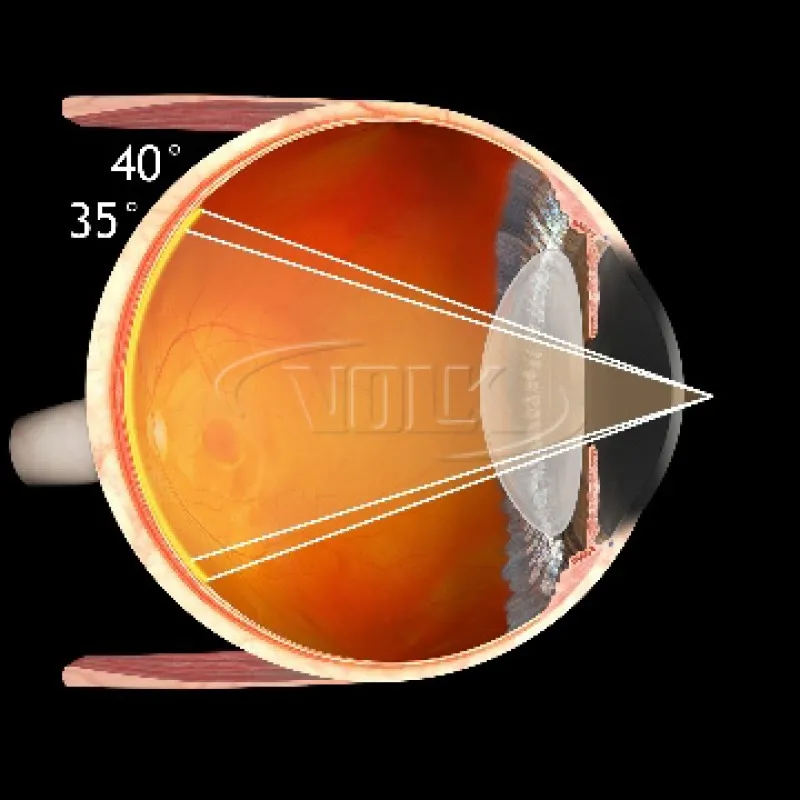 Fundus