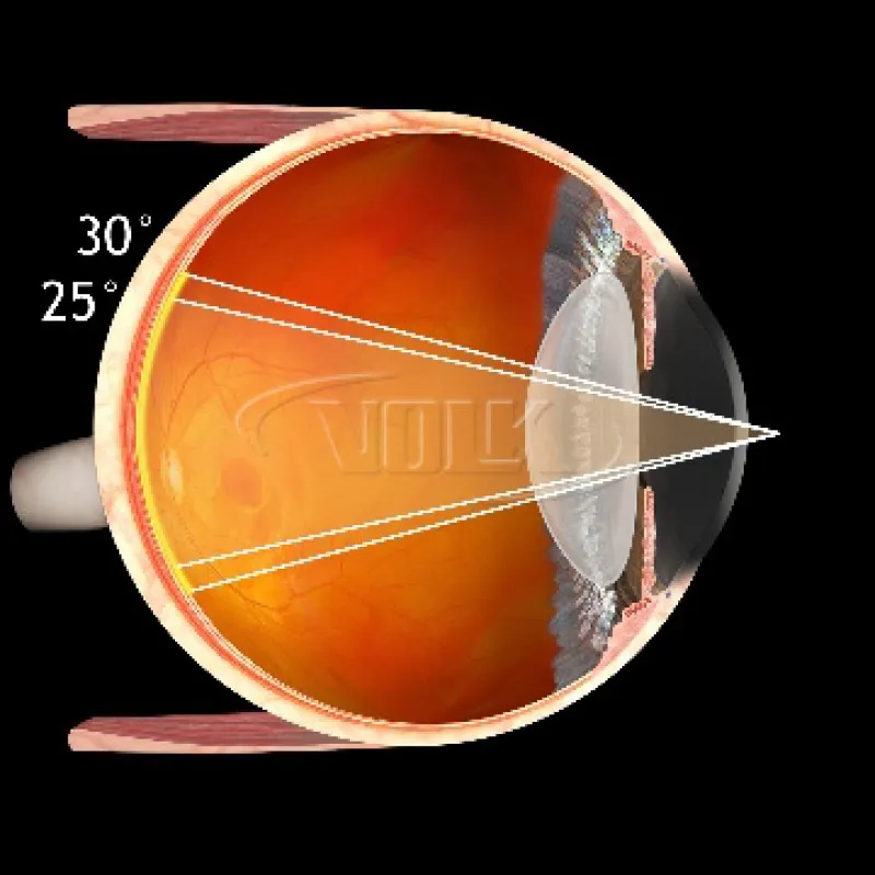 замовити, купити Fundus 20mm від Volk за низькою ціною в Україні