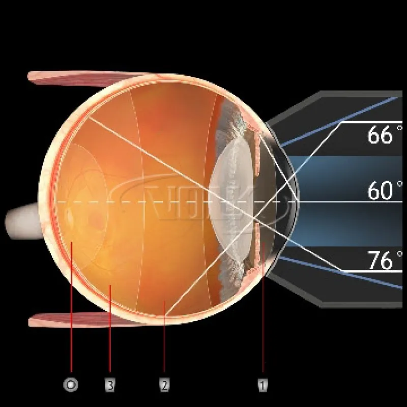 G-3 Gonio-Fundus