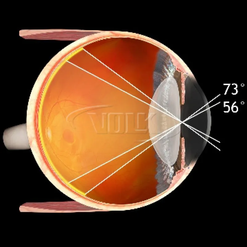 Класична лінза Pan Retinal® 2.2