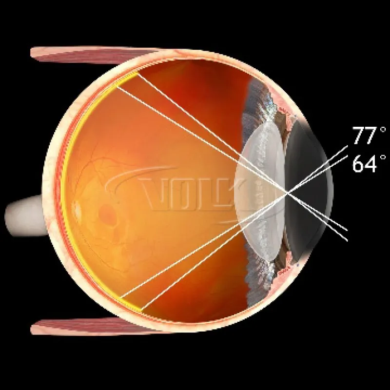 Super Macula©