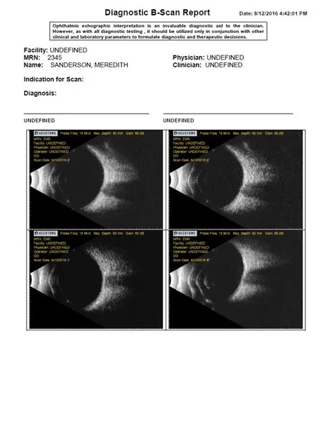 Ультразвуковий датчик В-Scan Plus