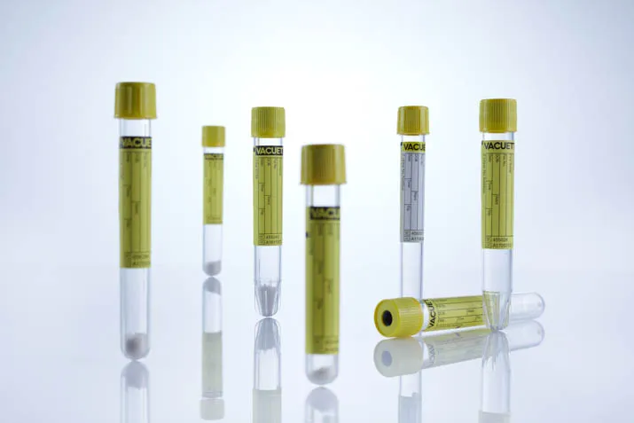 замовити, купити Пробірки для сечі VACUETTE® від Greiner Bio-One за низькою ціною в Україні