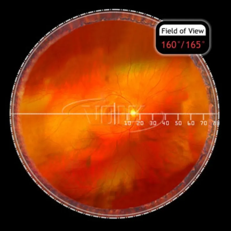 H-R Wide Field