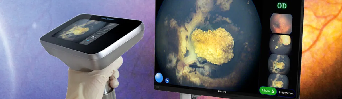 Педіатрична система PanoCam PRO